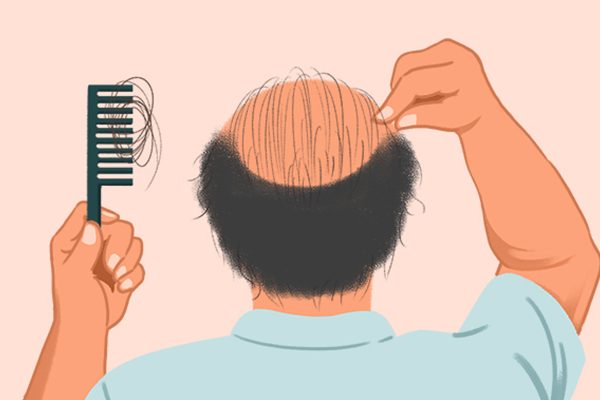 ��ʲôʳ���ͷ���� ��ͷ���õ�ʳ������Щ